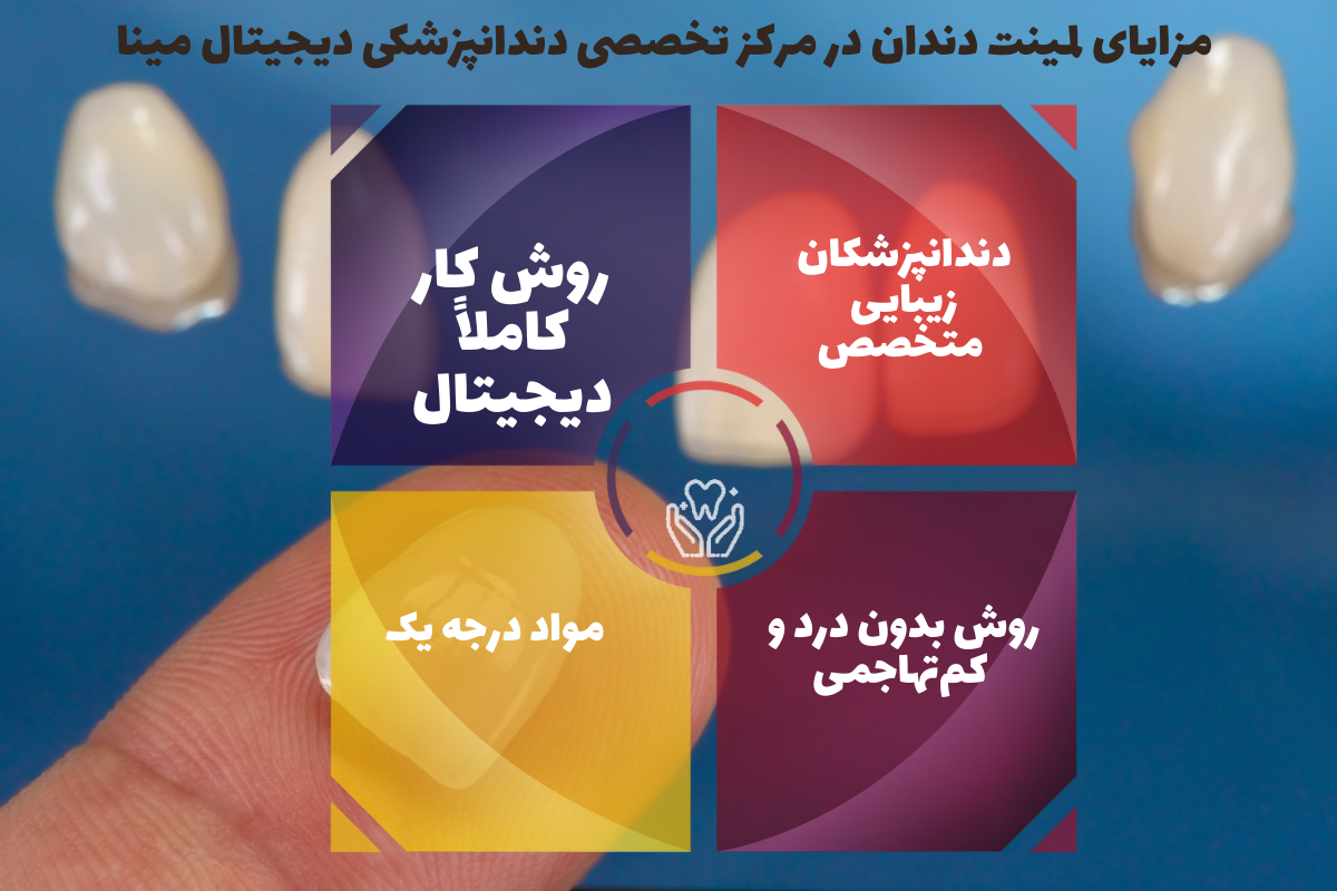 مزایای لمینت دندان در مرکز تخصصی دندانپزشکی دیجیتال مینا 