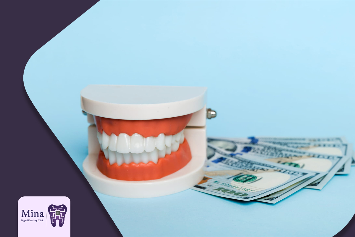قیمت لمینت دندان در تبریز 