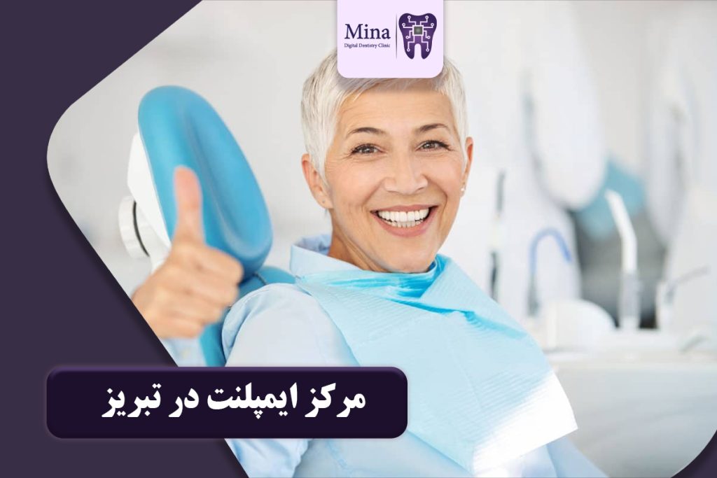 مرکز ایمپلنت در تبریز