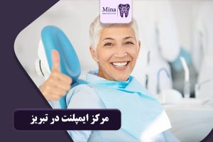 مرکز ایمپلنت در تبریز