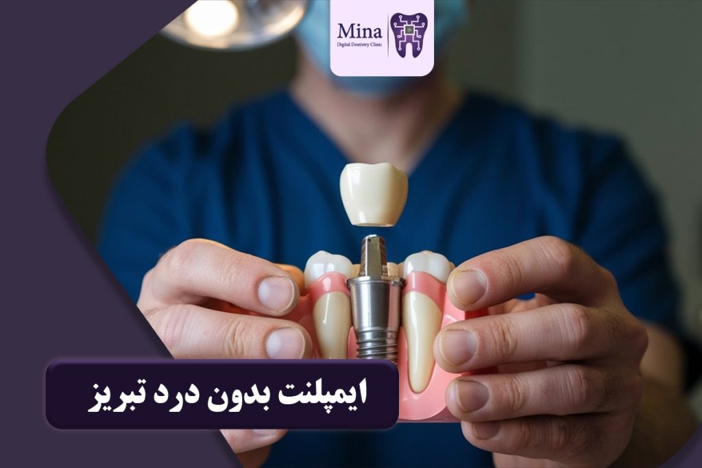 ایمپلنت بدون درد تبریز