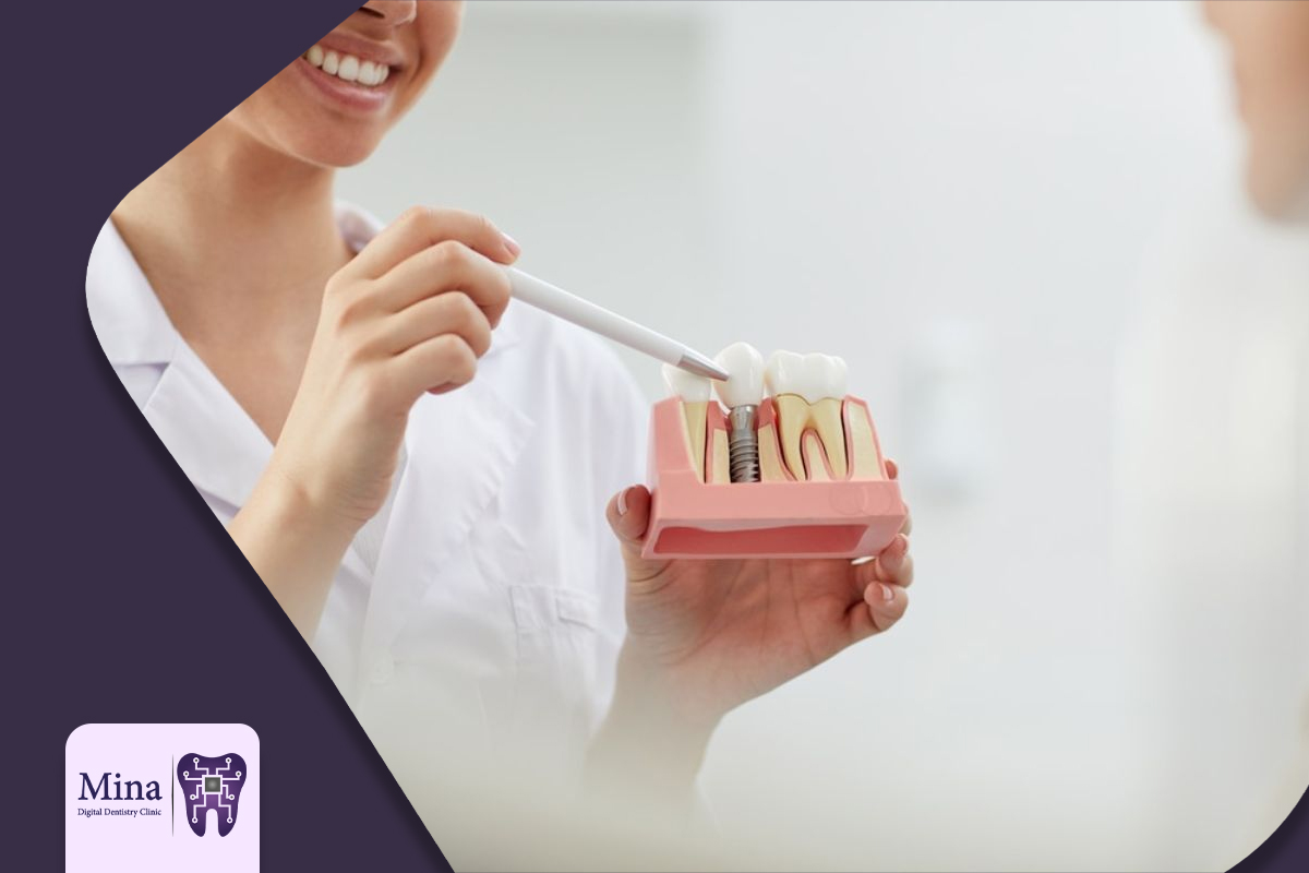 بهترین متخصص ایمپلنت تبریز 