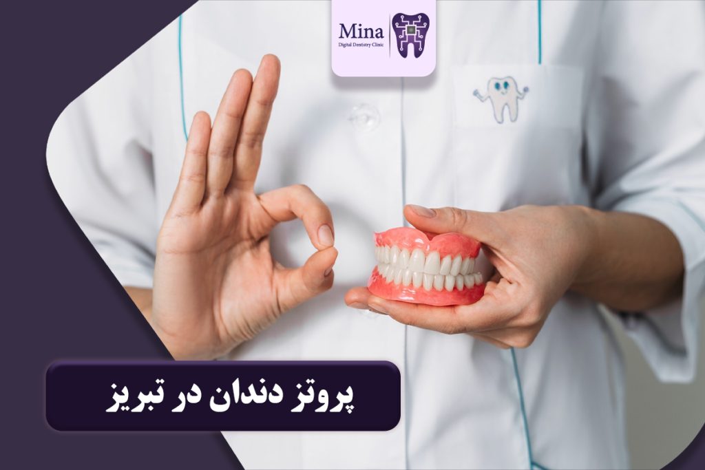 پروتز دندان در تبریز