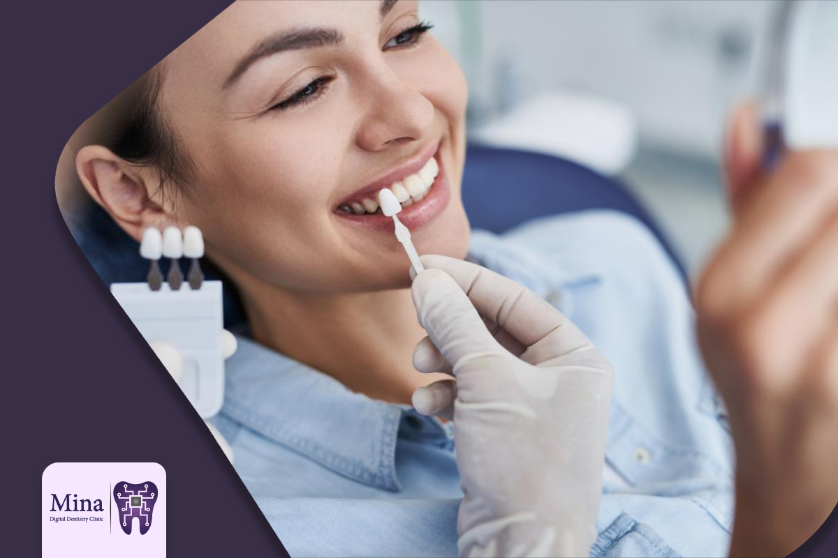 انجام لمینت در کلینیک مینا 
