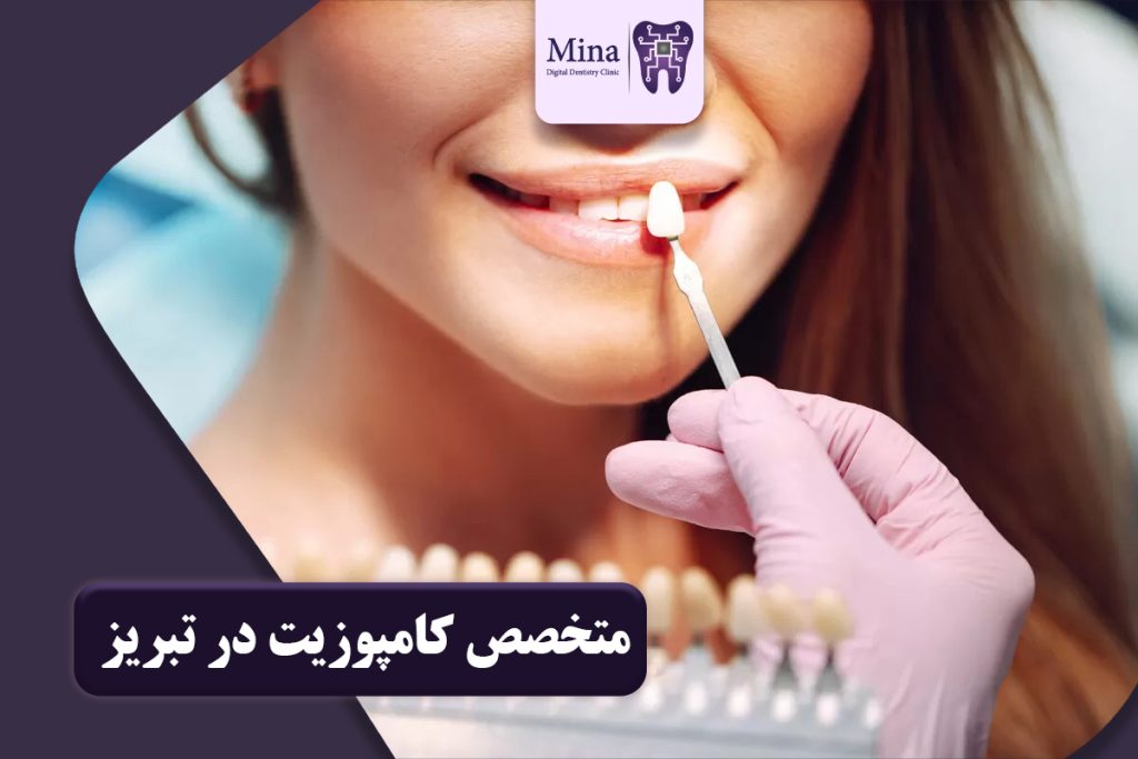 بهترین متخصص کامپوزیت در تبریز