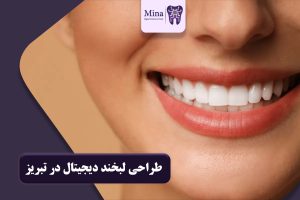 طراحی لبخند دیجیتال در تبریز