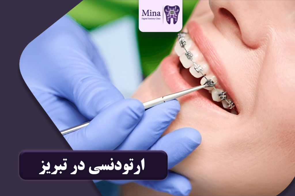 ارتودنسی در تبریز