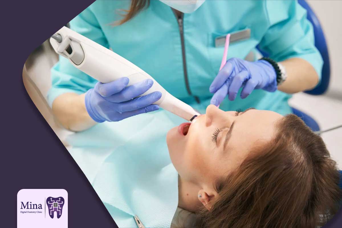 اسکنرهای دیجیتال 