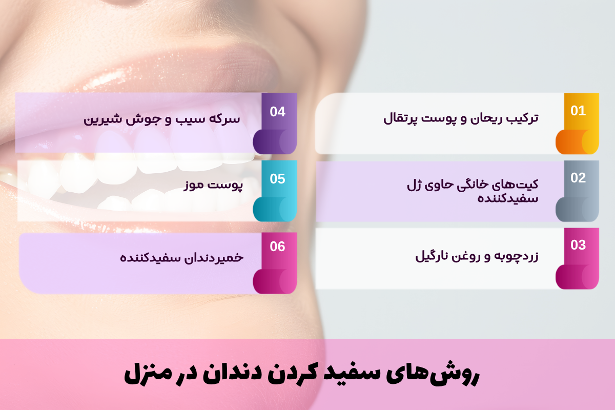 روش‌های سفید کردن دندان در منزل
