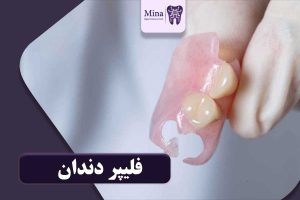 فلیپر دندان
