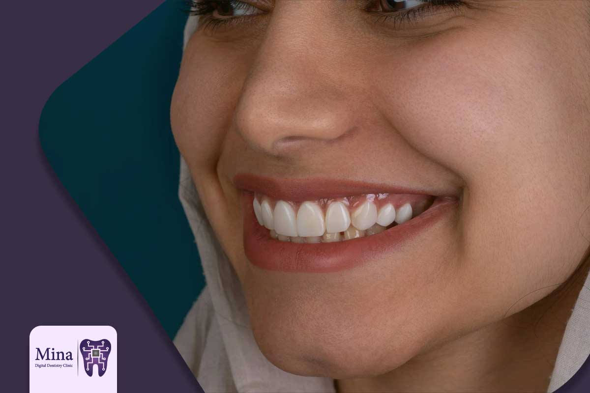 کاربردهای فلیپر دندان