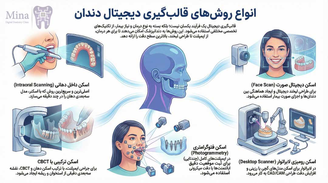 انواع روش‌های قالب‌گیری دیجیتال دندان