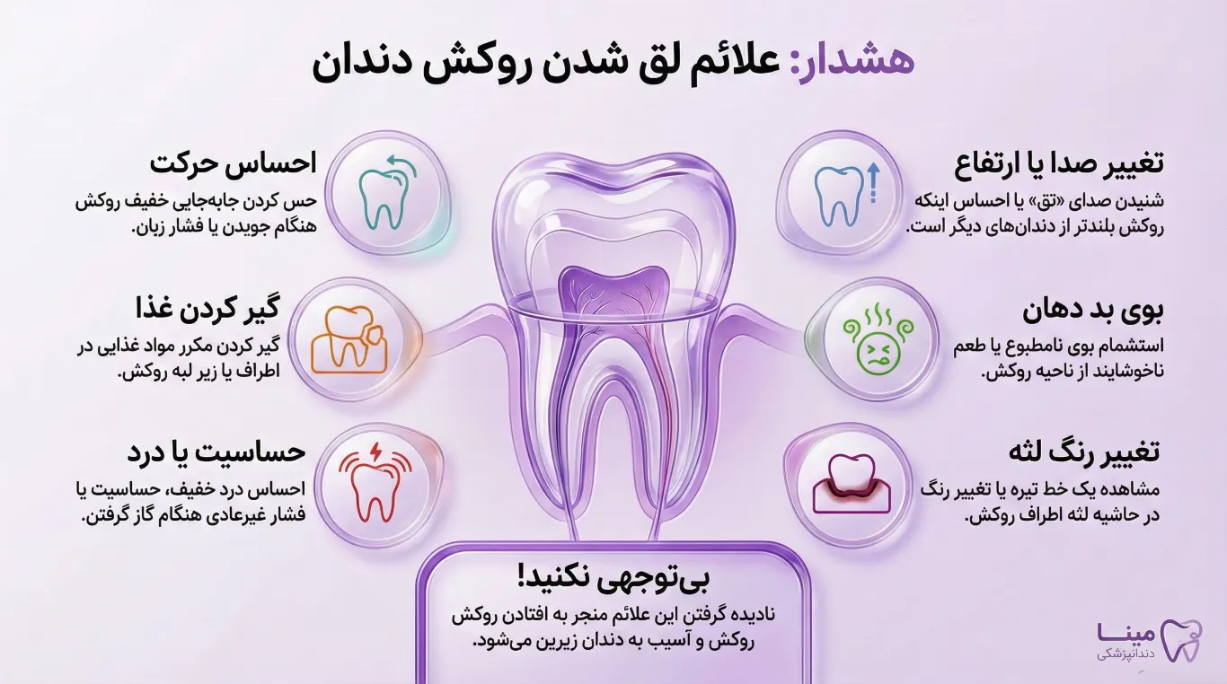 علائم لق شدن روکش دندان