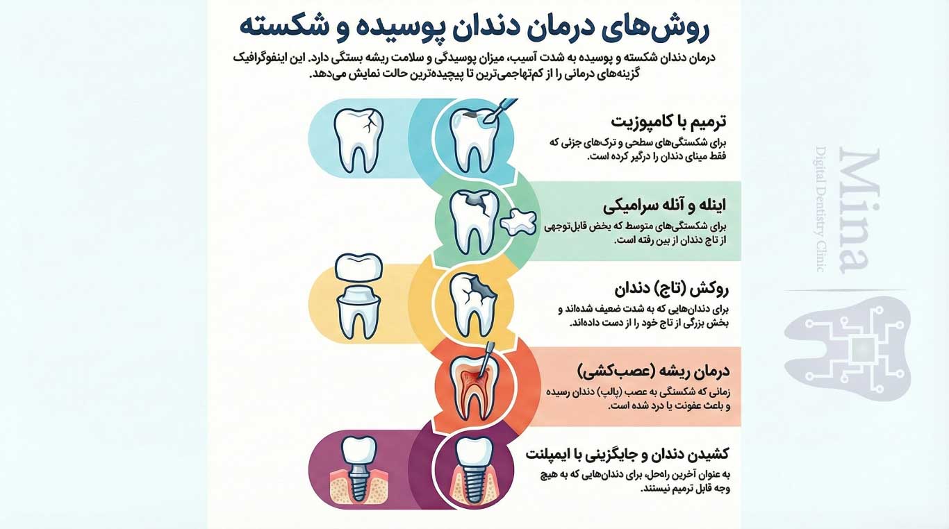 روشهای درمان دندان پوسیده شکسته