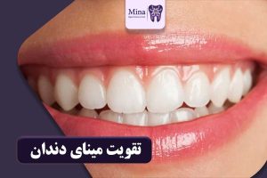 تقویت مینای دندان