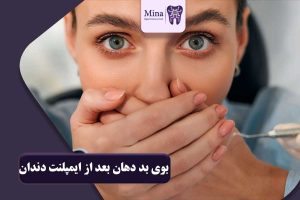 بوی بد دهان بعد از ایمپلنت دندان