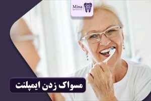 مسواک زدن ایمپلنت