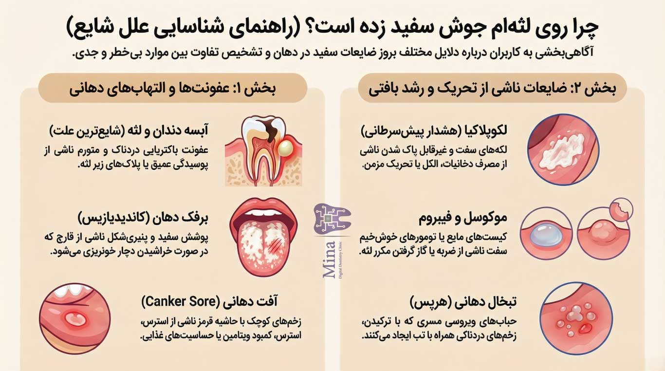علل شایع جوش سفید روی لثه