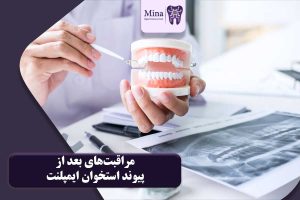 مراقبت‌های بعد از پیوند استخوان ایمپلنت دندان