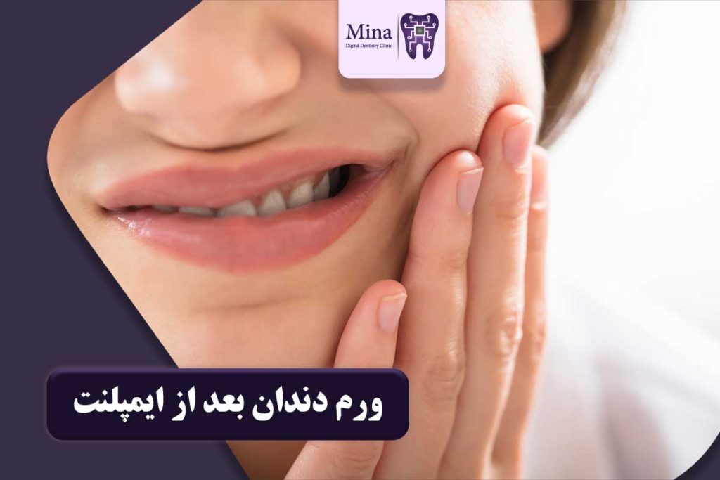 ورم دندان بعد از ایمپلنت