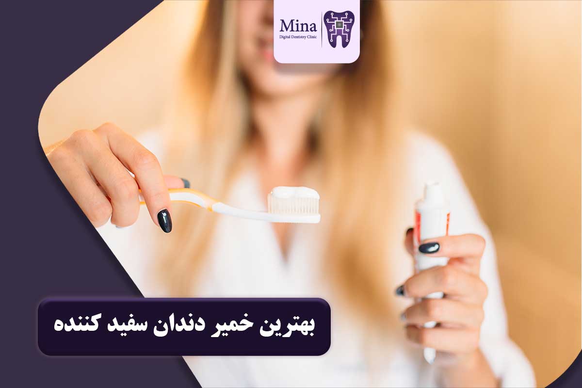 جدول راهنمای انتخاب بهترین خمیر دندان بر اساس شرایط دهان و دندان