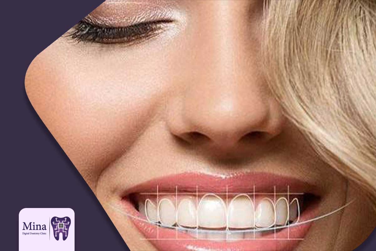 مقایسه دندانپزشکی زیبایی سنتی و دیجیتال