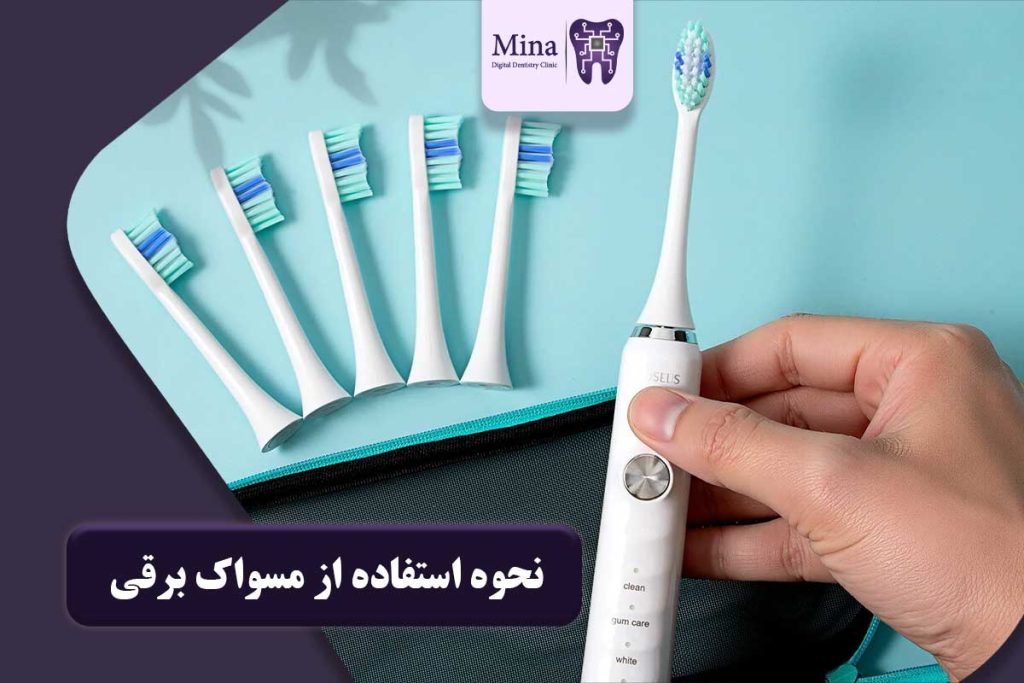 مسواک برقی