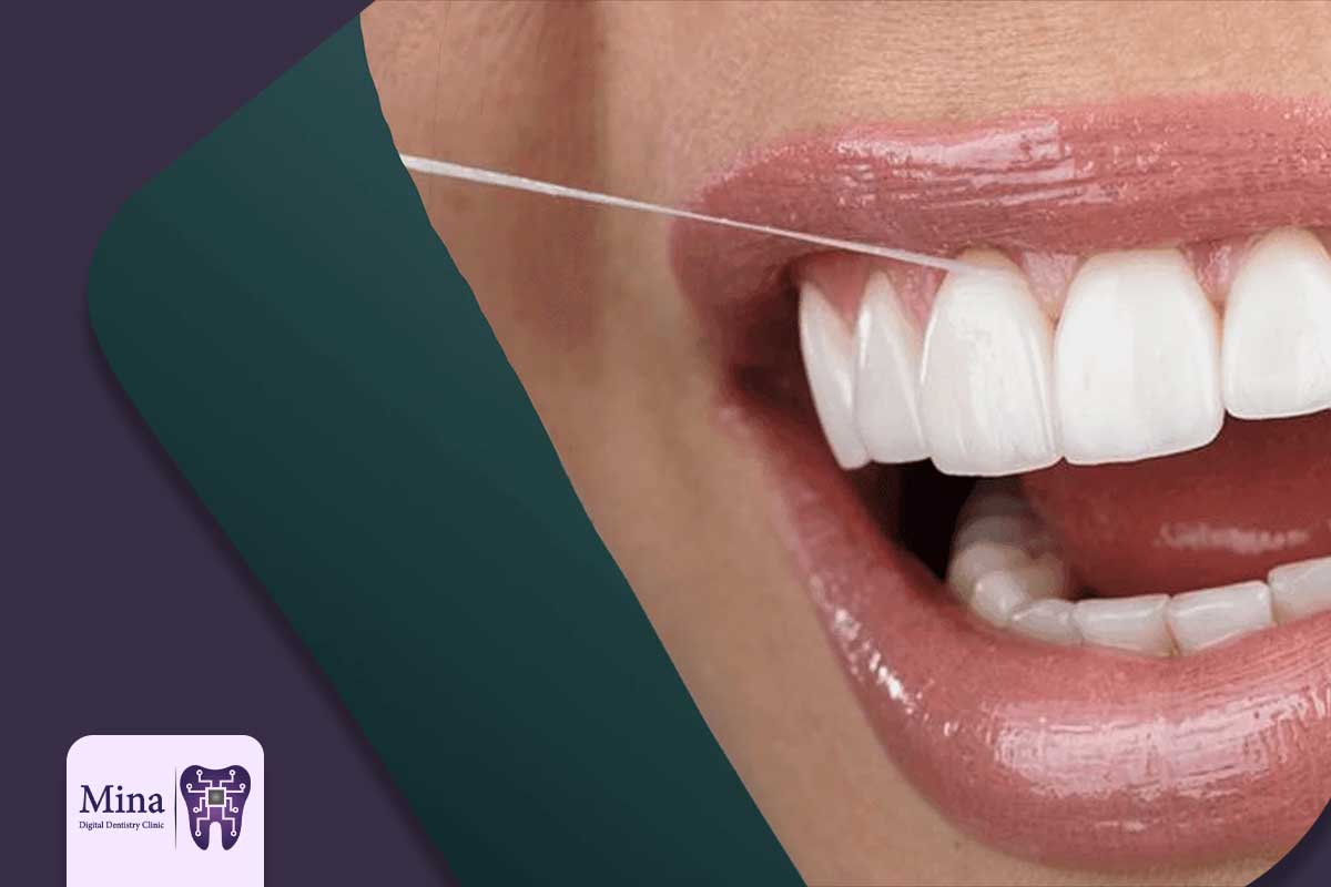 مقایسه طول عمر و ویژگی‌های انواع لمینت: کدام یک برای شما مناسب‌تر است؟
