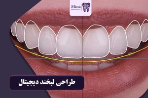 طراحی لبخند دیجیتال