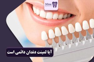 آیا لمینت دندان دائمی است