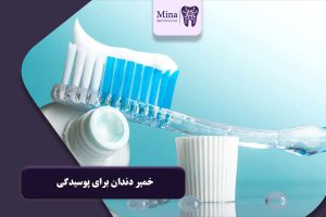 خمیر دندان برای پوسیدگی
