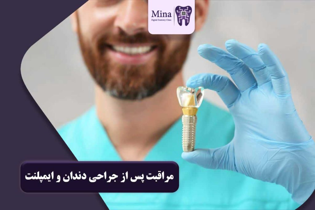 مراقبت پس از جراحی دندان و ایمپلنت