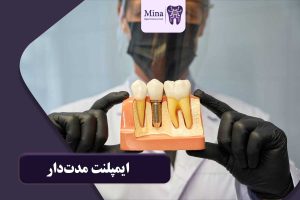 ایمپلنت مدتدار