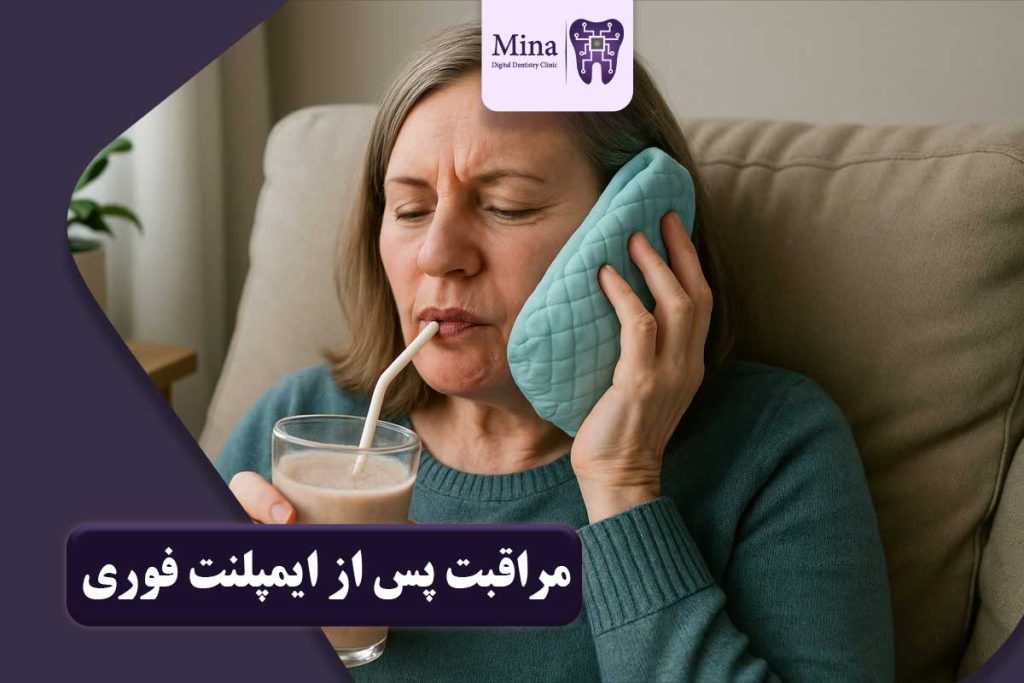 مراقبت پس از ایمپلنت فوری