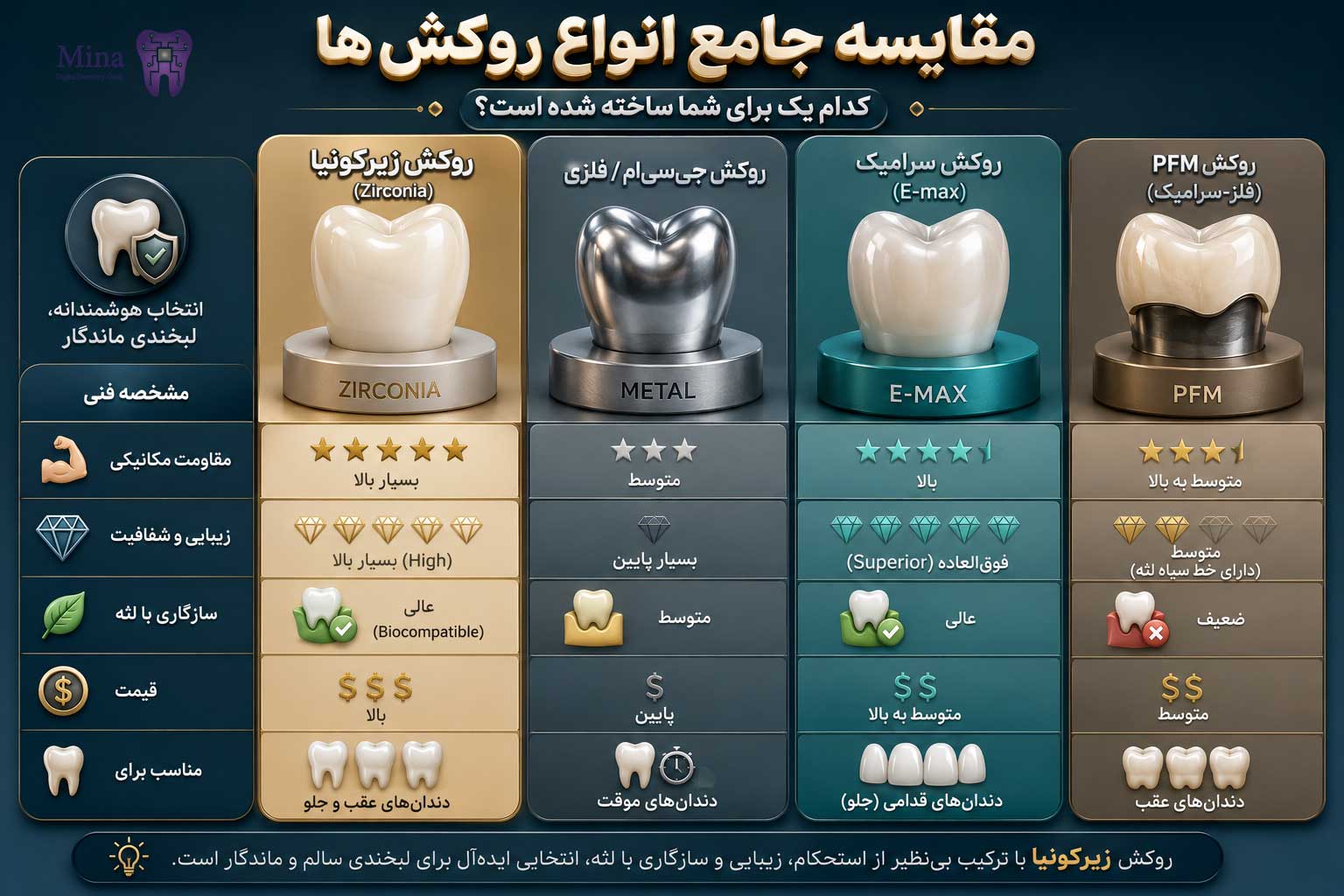 مقایسه جامع انواع روکشها