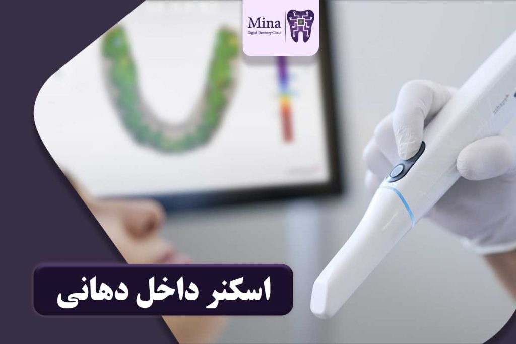 اسکنر داخل دهانی