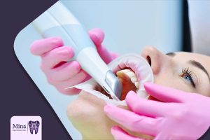 Intraoral-scanner-features