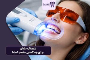بلیچینگ دندان برای چه کسانی مناسب است؟