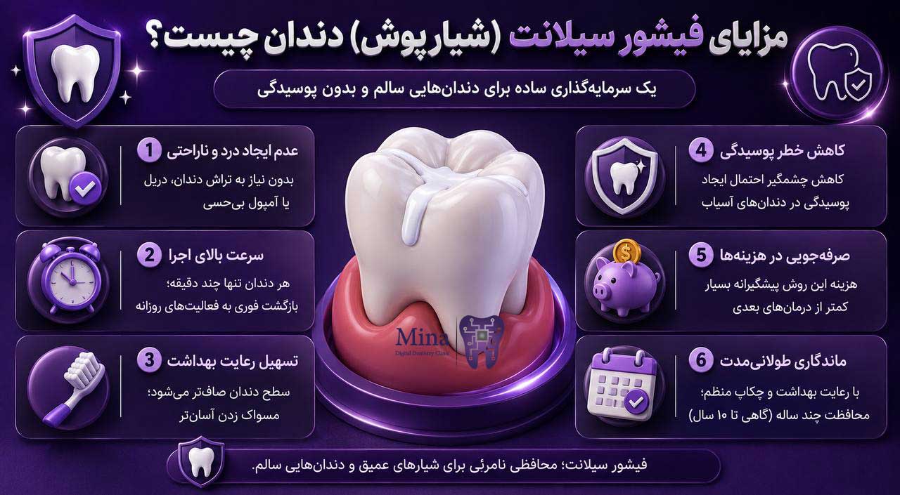 مزایای فیشور سیلانت یا شیارپوش دندان