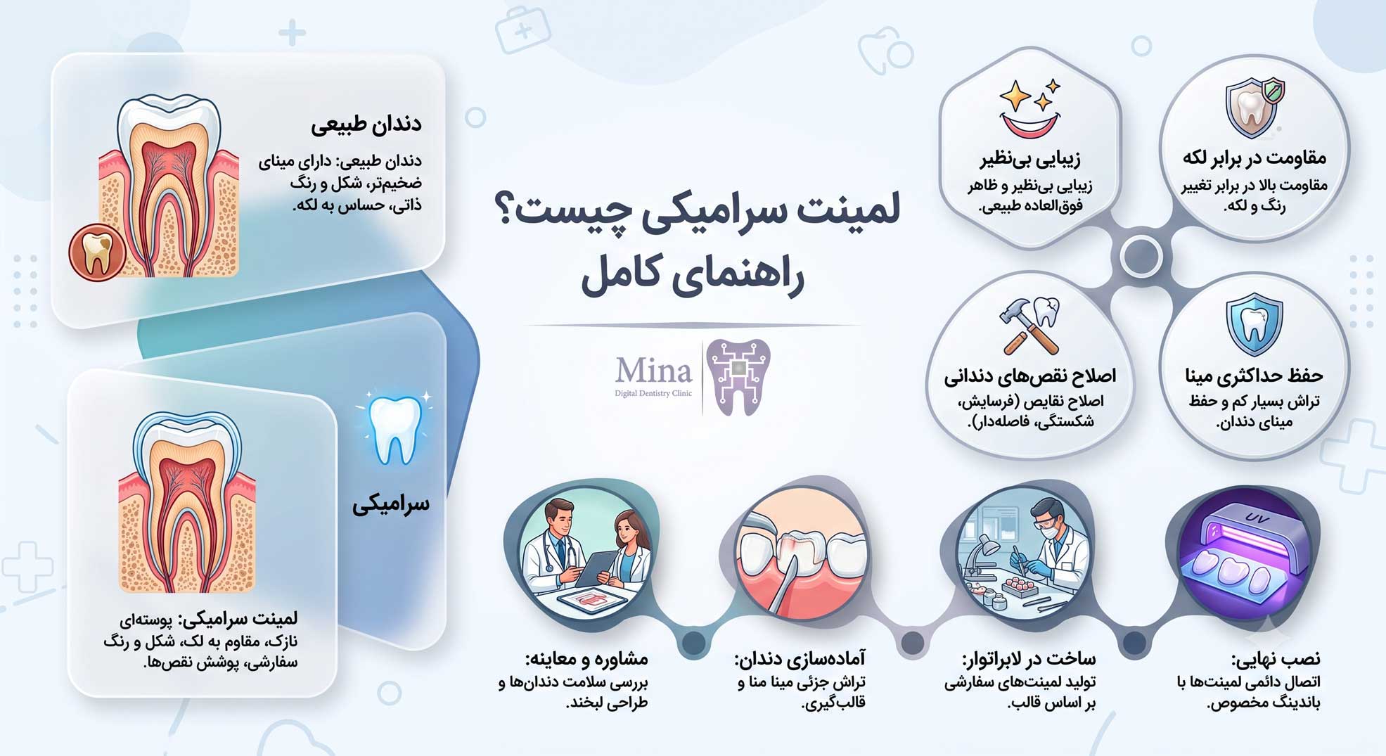 مزایای لمینت دندان 