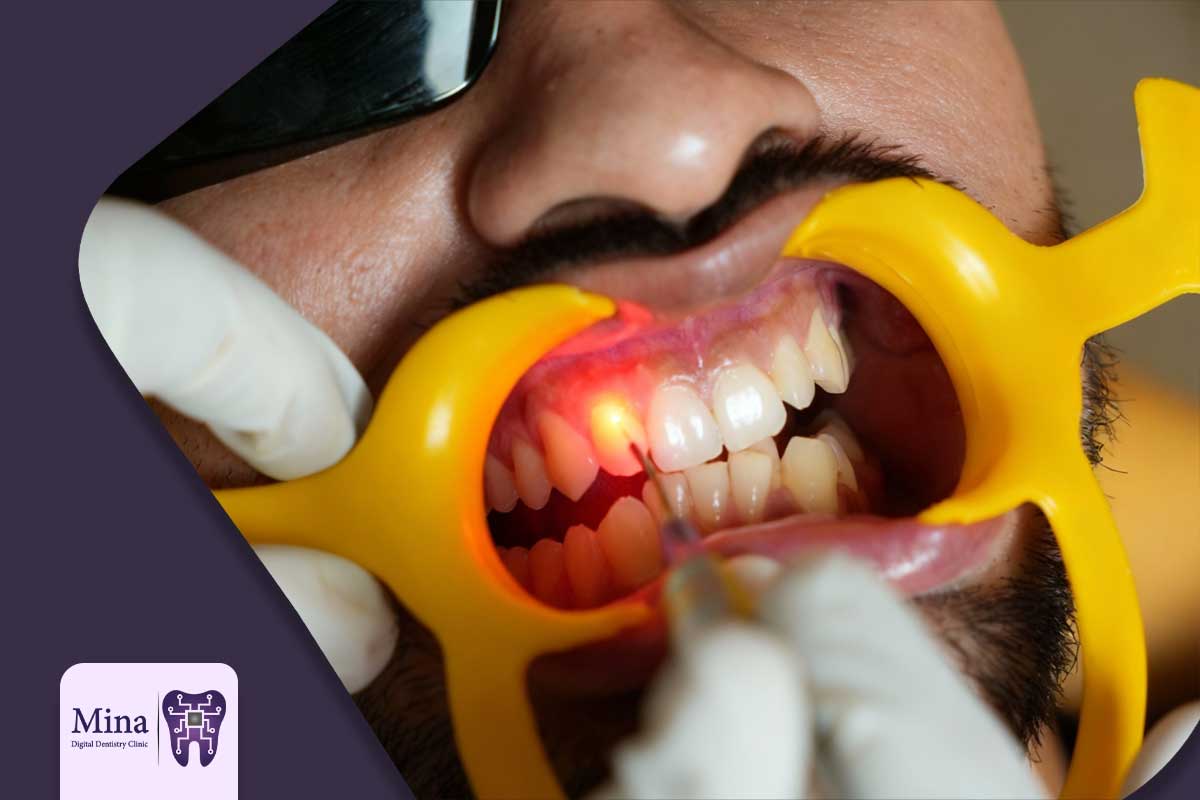 مزایای دندانپزشکی با لیزر در تبریز