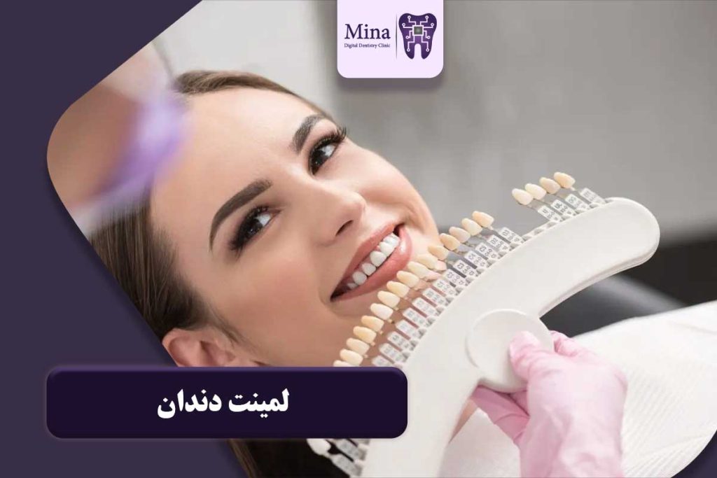 لمینت دندان