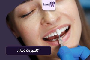 کامپوزیت دندان