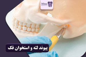 پیوند لثه و استخوان فک