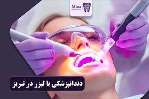 دندانپزشکی با لیزر در تبریز