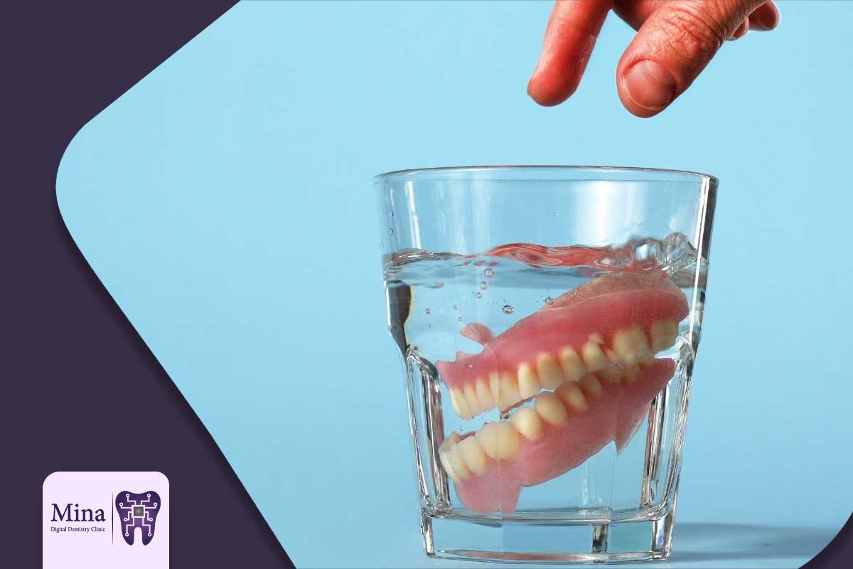 نگهداری و مراقبتهای پس از درمان پروتزهای دندانی