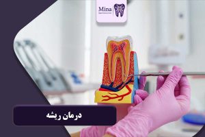 درمان ریشه