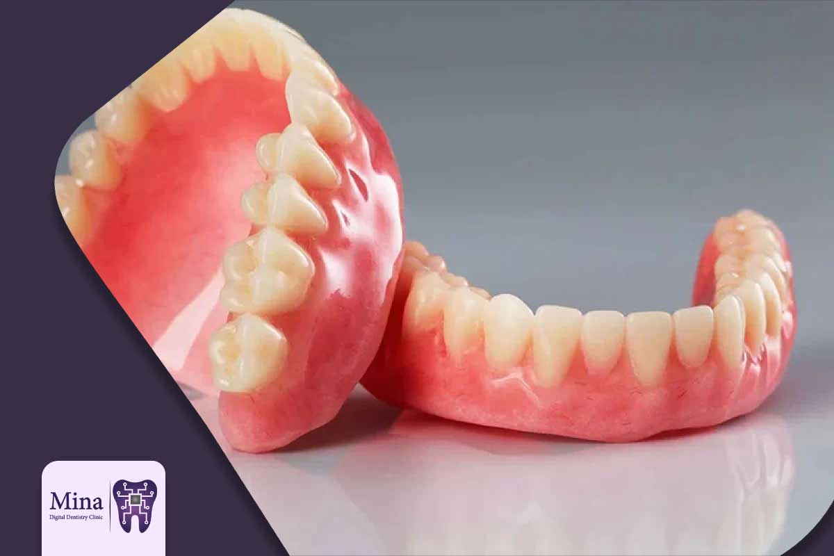 خدمات پروتز و روکش در همان روز