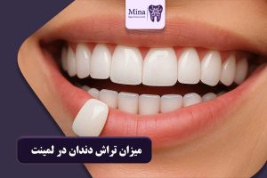 میزان تراش دندان در لمینت