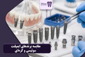 مقایسه برندهای ایمپلنت سوئیسی و کرهای